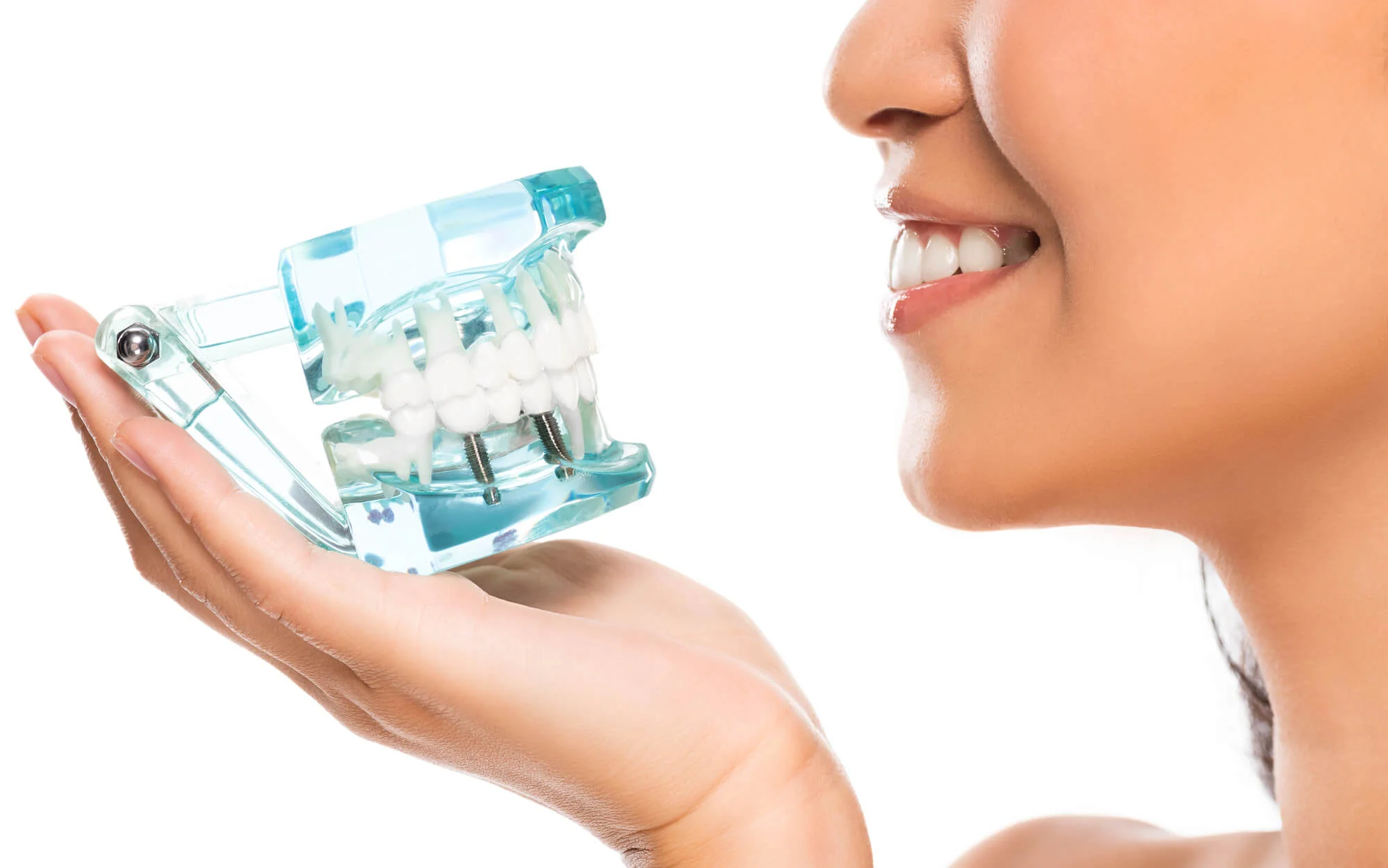 Woman holding dental model with implants smiling – affordable denture