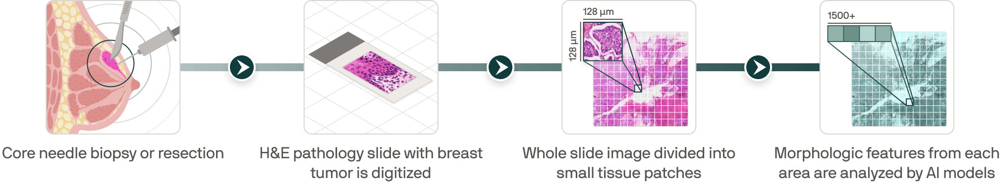 Four-step diagram showing breast tumor biopsy, digitization of H&E pathology slide, division of the slide into small tissue patches of 128 by 128 micrometers, and analysis of morphologic features by AI models.
