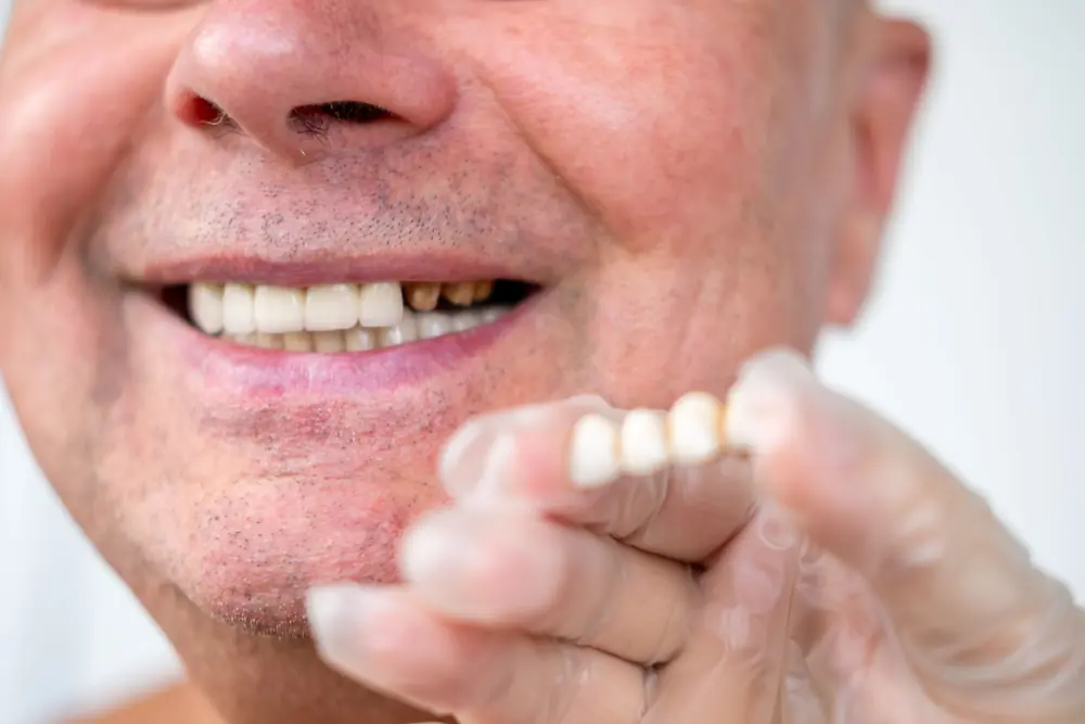 Patient holding a dental bridge restoration