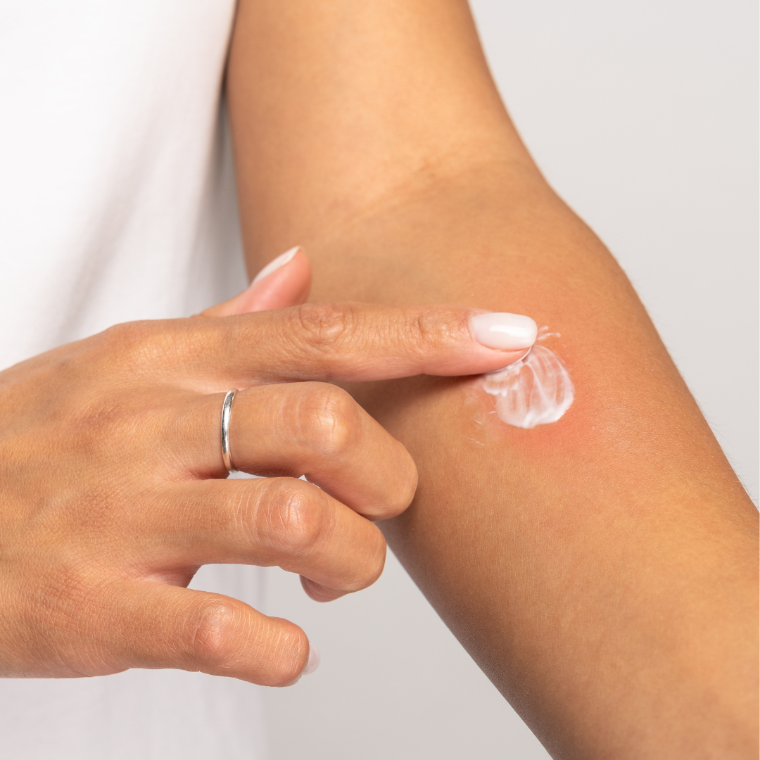 Summer 2025 Bug Bite & Sting Prevention Guide