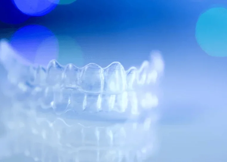 Clear aligner on blue reflective surface clear aligners near you
