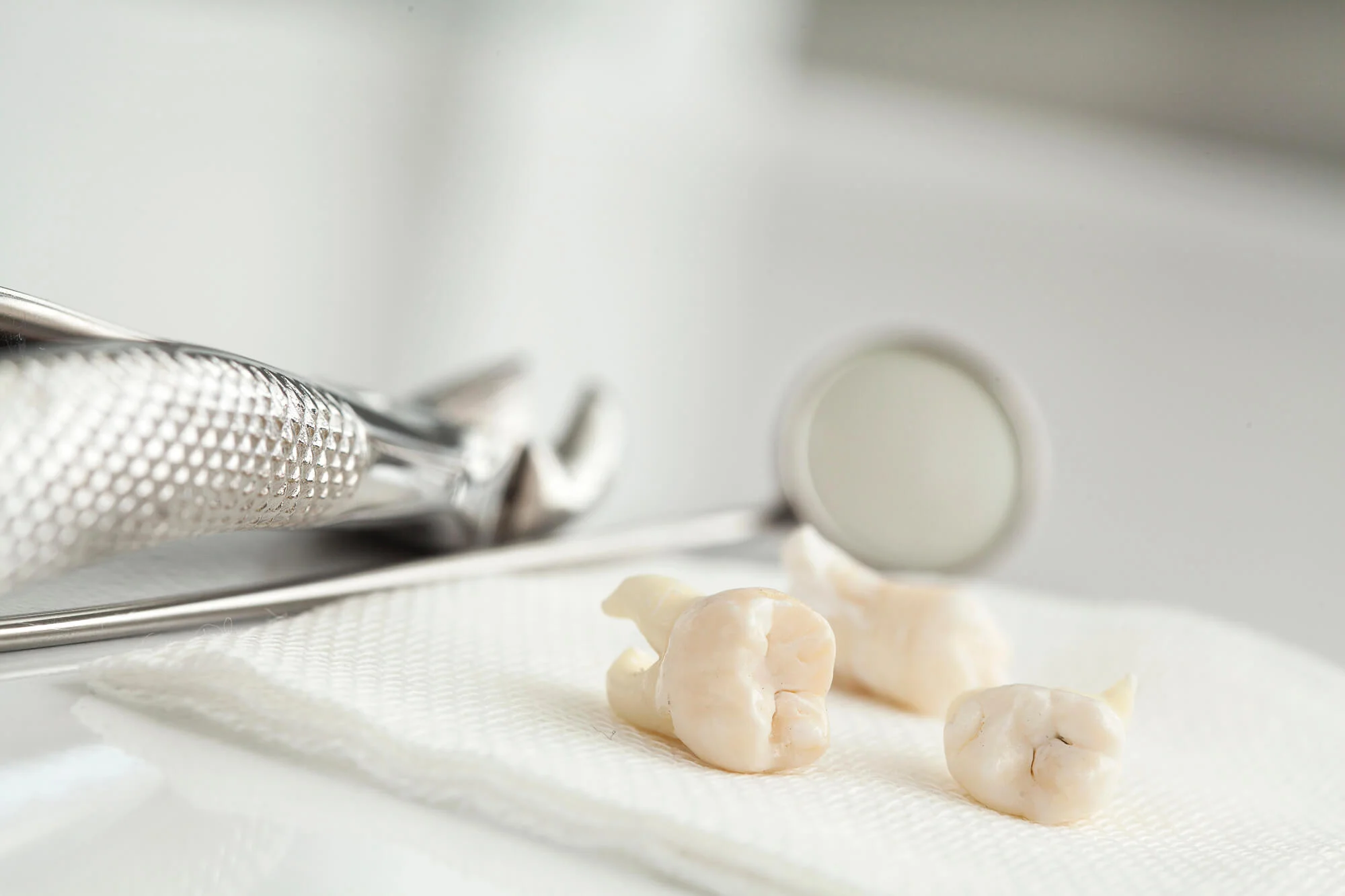 Wisdom tooth extraction in Little Elm, TX procedure
