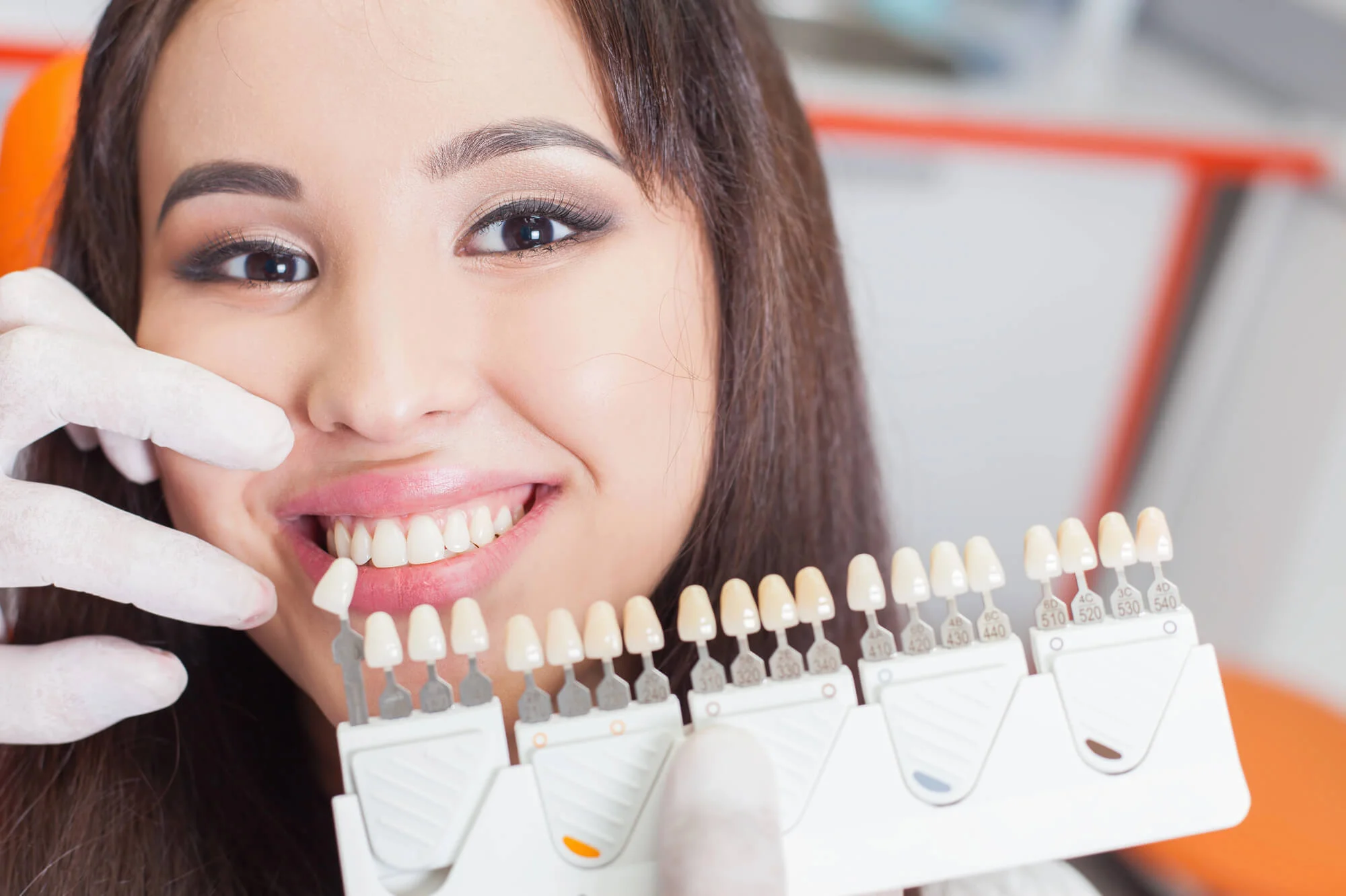 Veneer shade matching, cosmetic dentistry porcelain veneers