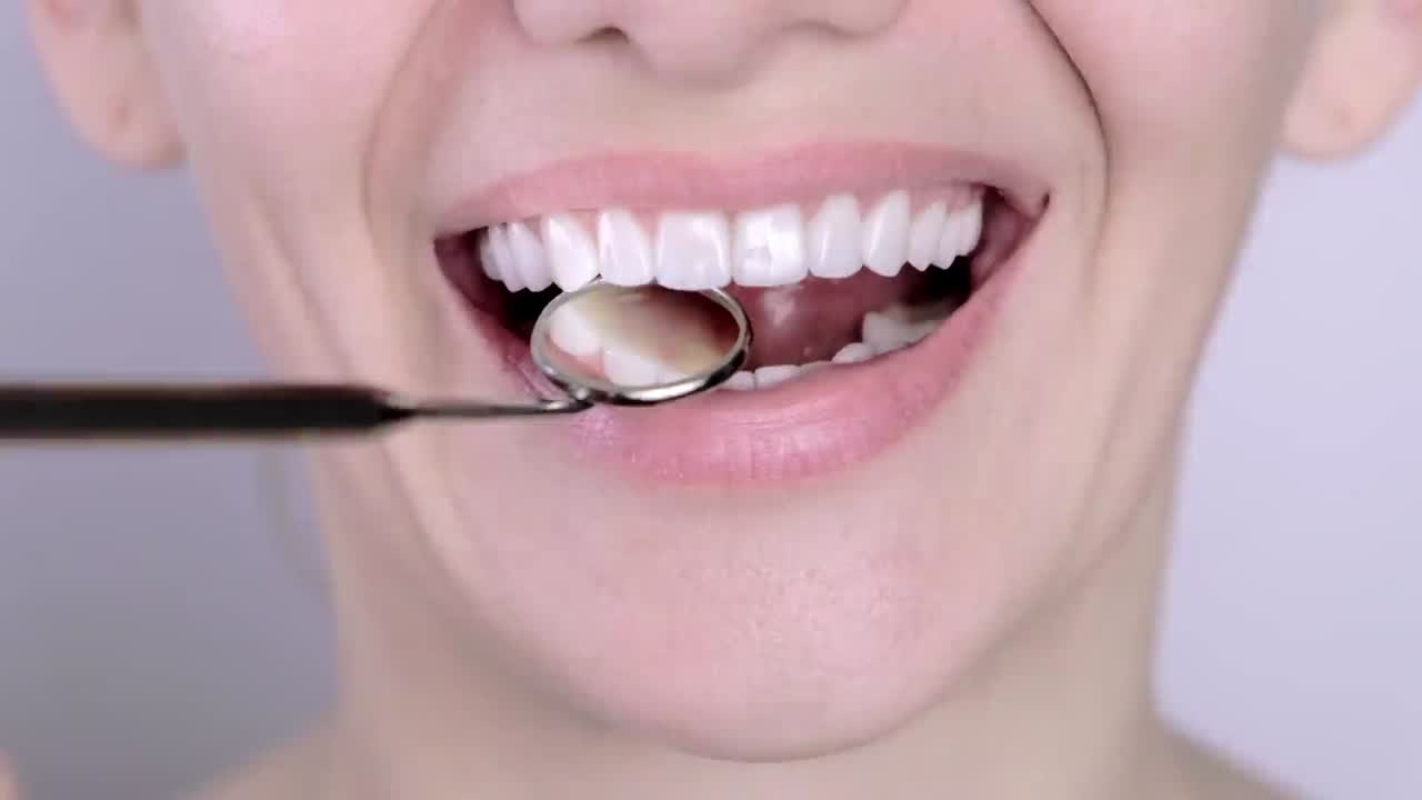 INVISALIGN ZAHNSPANGE WIEN / UNSICHTBARE ZAHNSPANGE, image size:1280x720