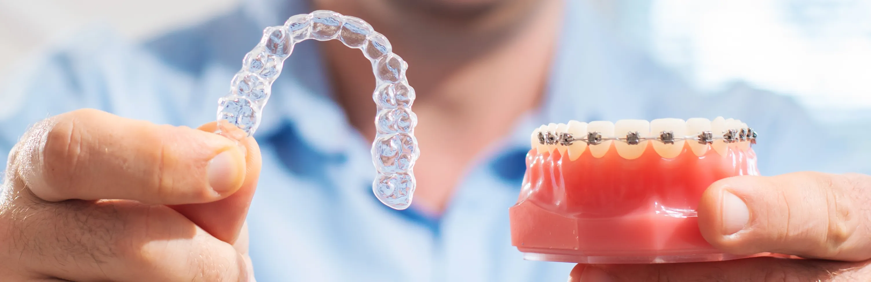 Invisalign vs. Braces: Which Is the Best Choice for Your Smile in Tampa?