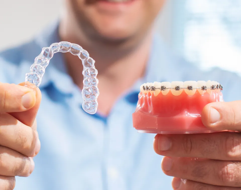 Invisalign vs. Braces: Which Is the Best Choice for Your Smile in Tampa?