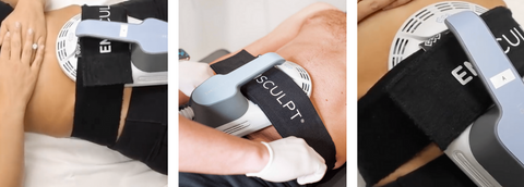 Emsculpt