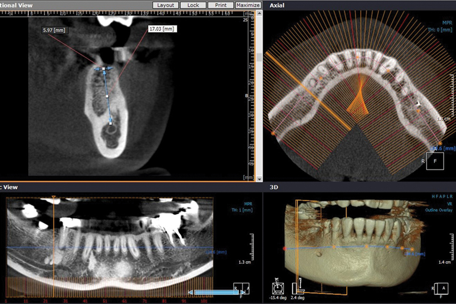 Advanced Dental Diagnostics & 3D CBCT X-Ray 