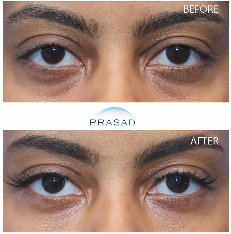 a young female in 30s showcasing bright young eyes 
