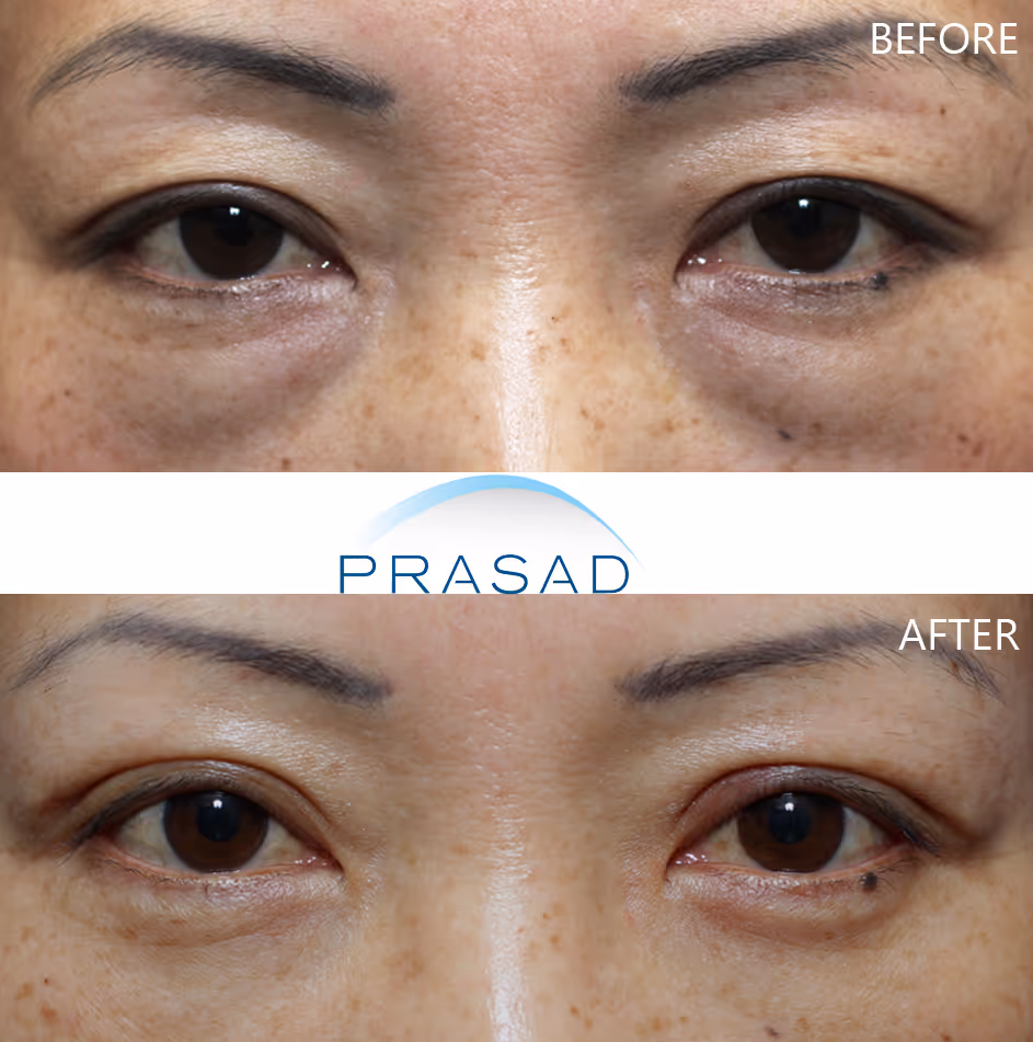 Transformation of a middle-aged Asian woman