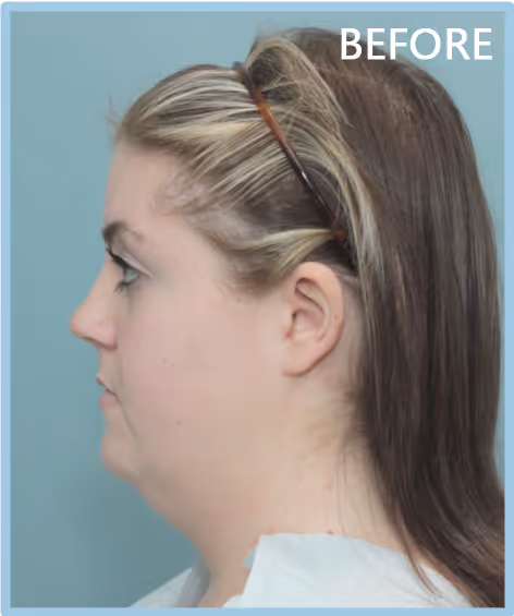 A female with tired looking eyes and obvious under eye bags