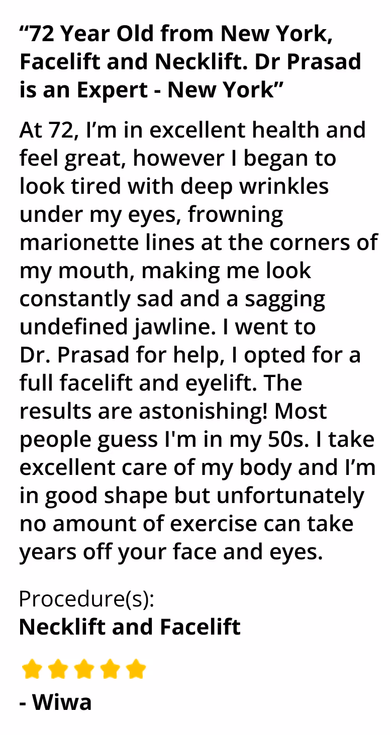 "Dr. Prasad is an expert" - patient review on neck lipo and facelift performed by Dr. Prasad