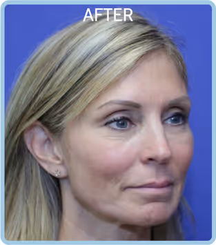 A female with younger looking eyes and fresh look