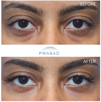 a young female in 30s showcasing bright young eyes 