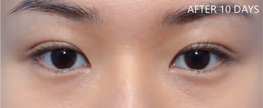 A female with younger looking eyes and fresh look