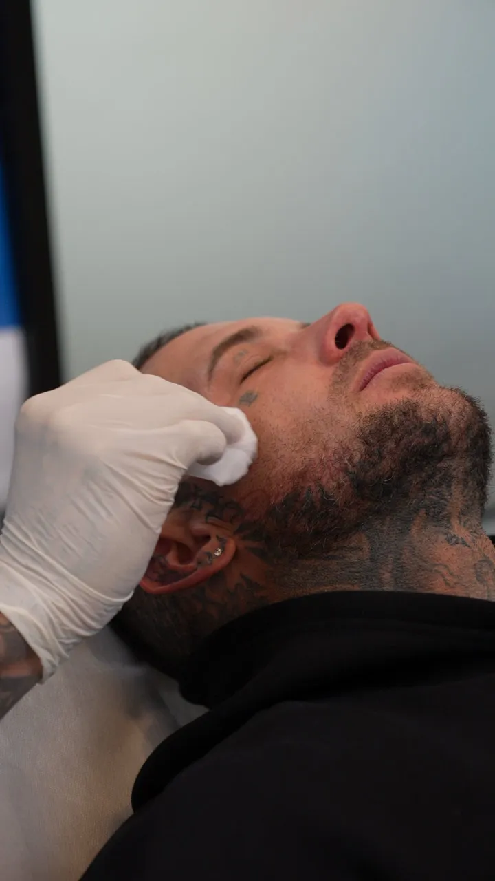 tattoo removal brisbane