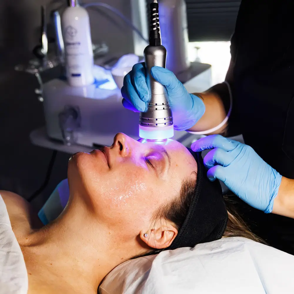 Close-up of a Diamond Hydrofacial treatment on a client's forehead