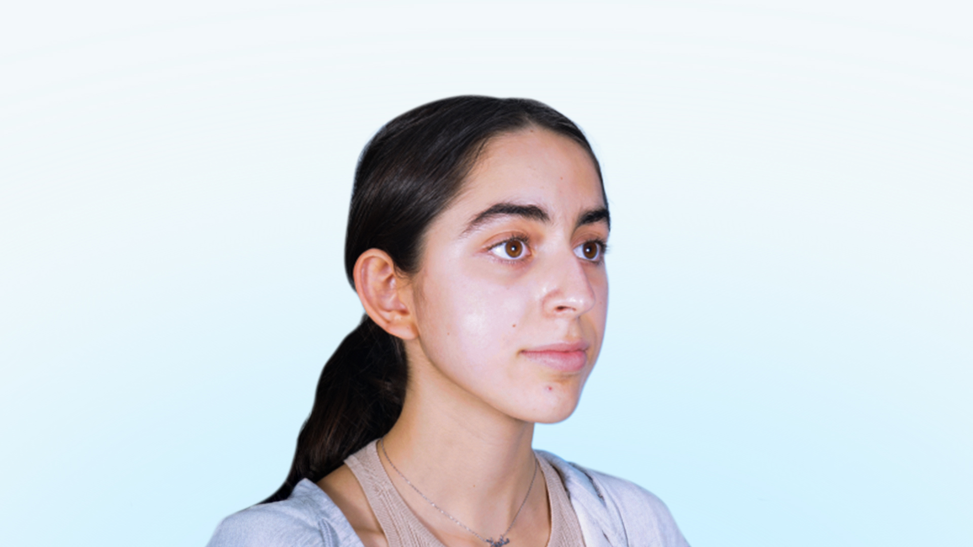 Paciente femenina en fase preoperatoria con desviación nasal y orejas prominentes.