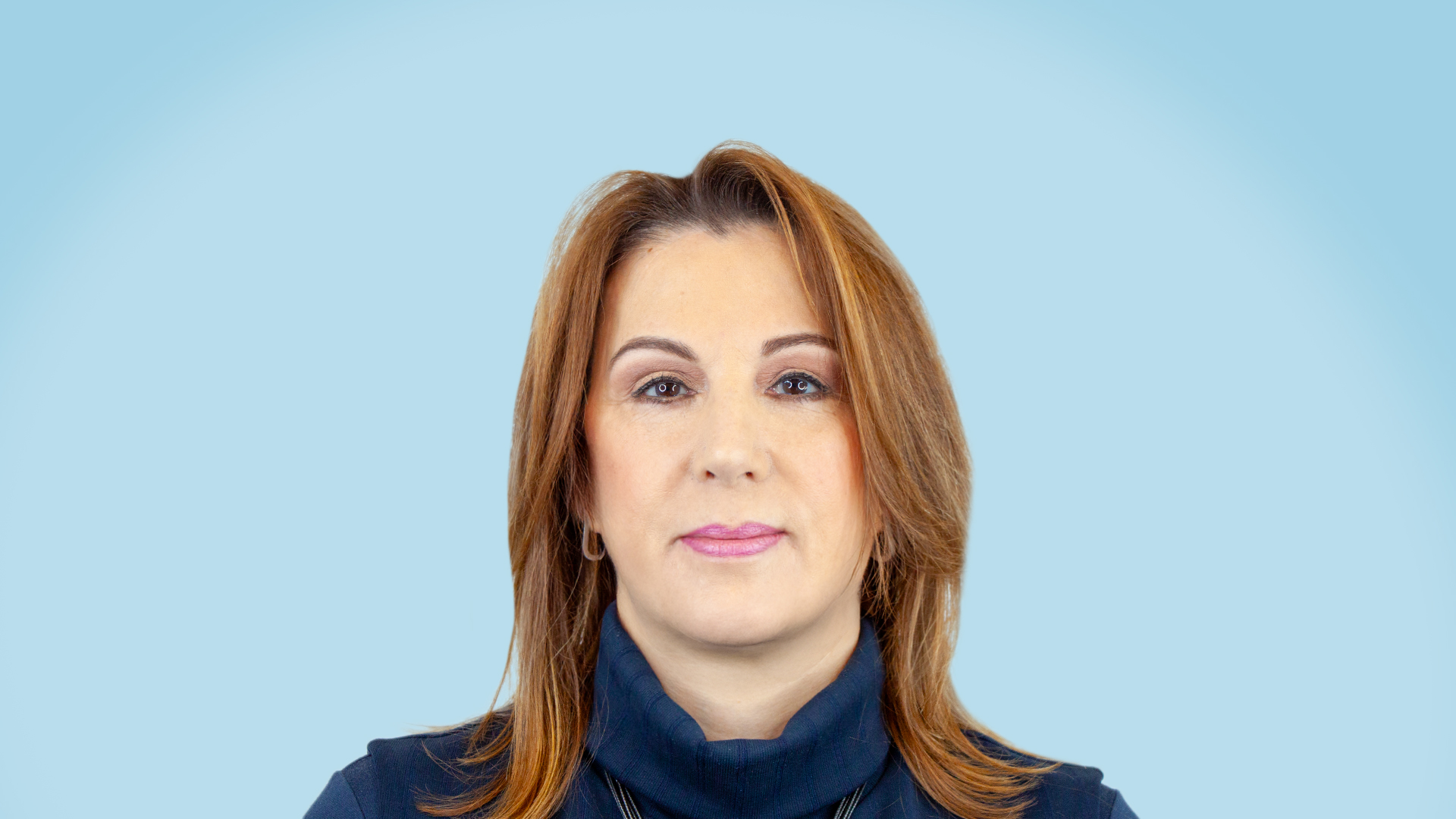 Resultado postoperatorio tras cervicoplastia. Cuello estilizado, perfil armónico y aspecto rejuvenecido.
