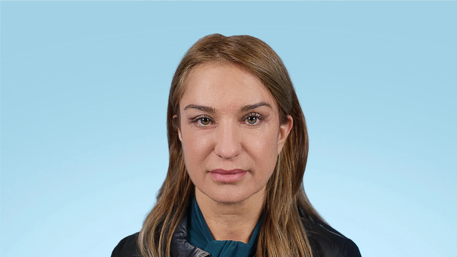 Resultado postoperatorio tras blefaroplastia completa y frontoplastia endoscópica, mirada rejuvenecida y expresión armónica