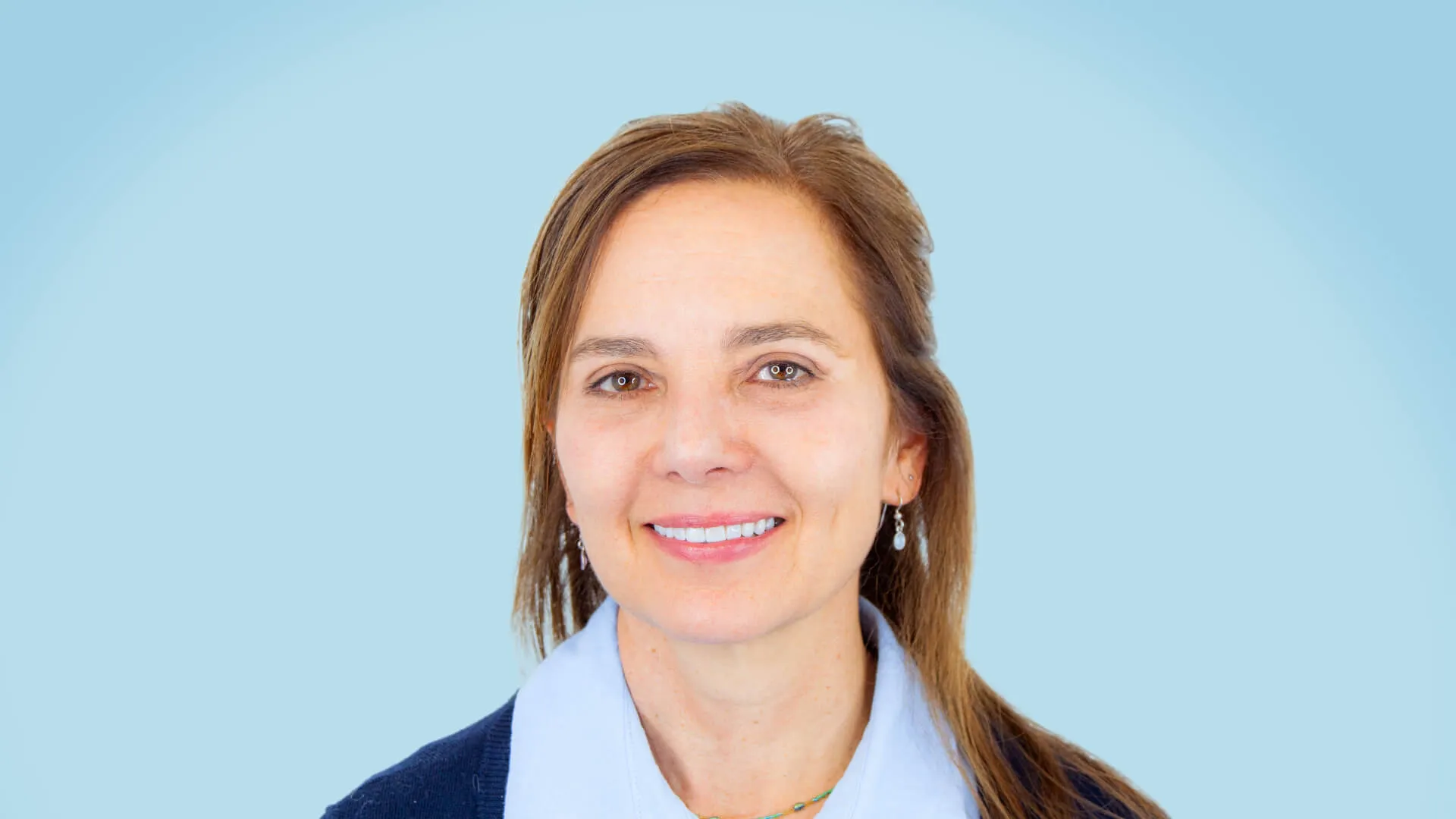 Resultado postoperatorio tras blefaroplastia completa y septorrinoplastia funcional–estética. Mirada rejuvenecida, perfil nasal armónico y respiración mejorada.