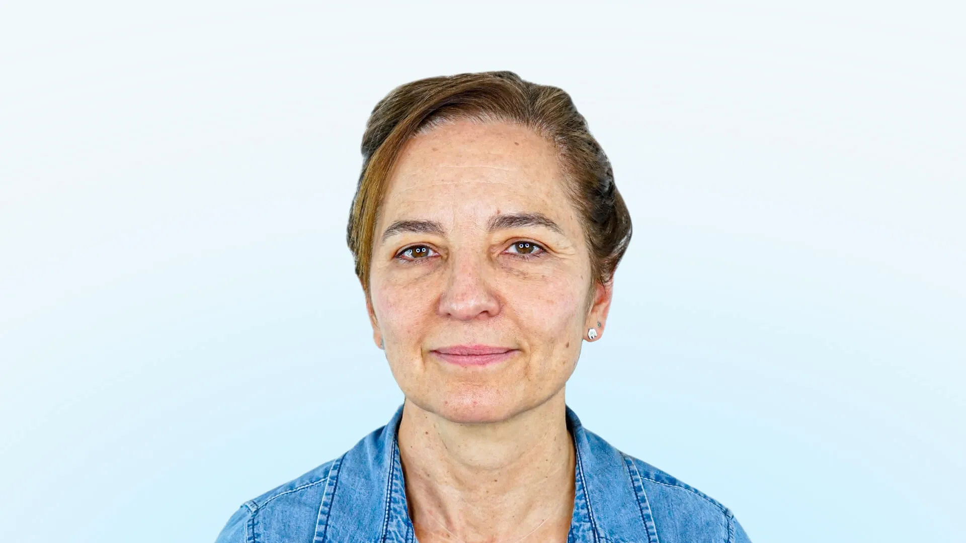 Paciente femenina con párpados superiores caídos, bolsas palpebrales y desviación nasal visible.