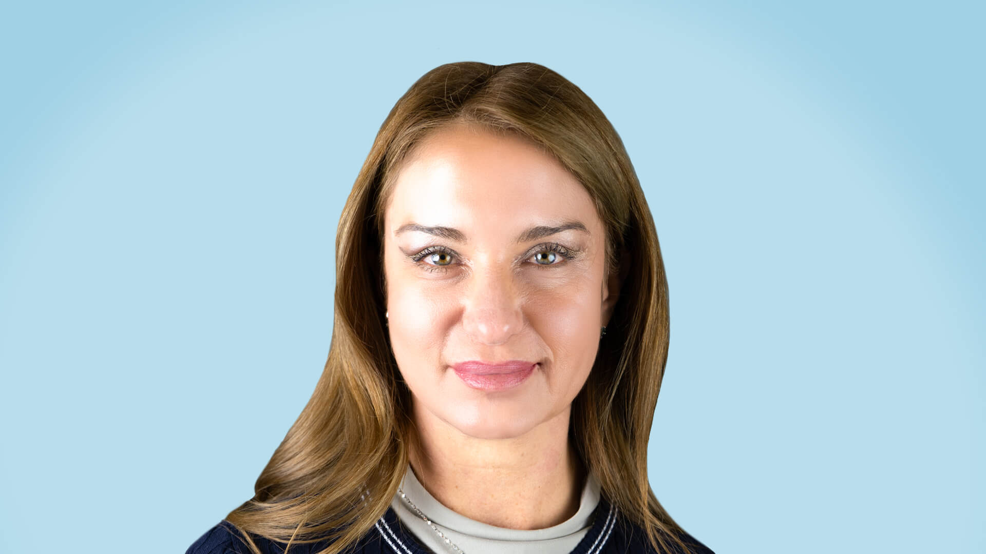 Resultado postoperatorio tras blefaroplastia completa y frontoplastia endoscópica, mirada rejuvenecida y expresión armónica