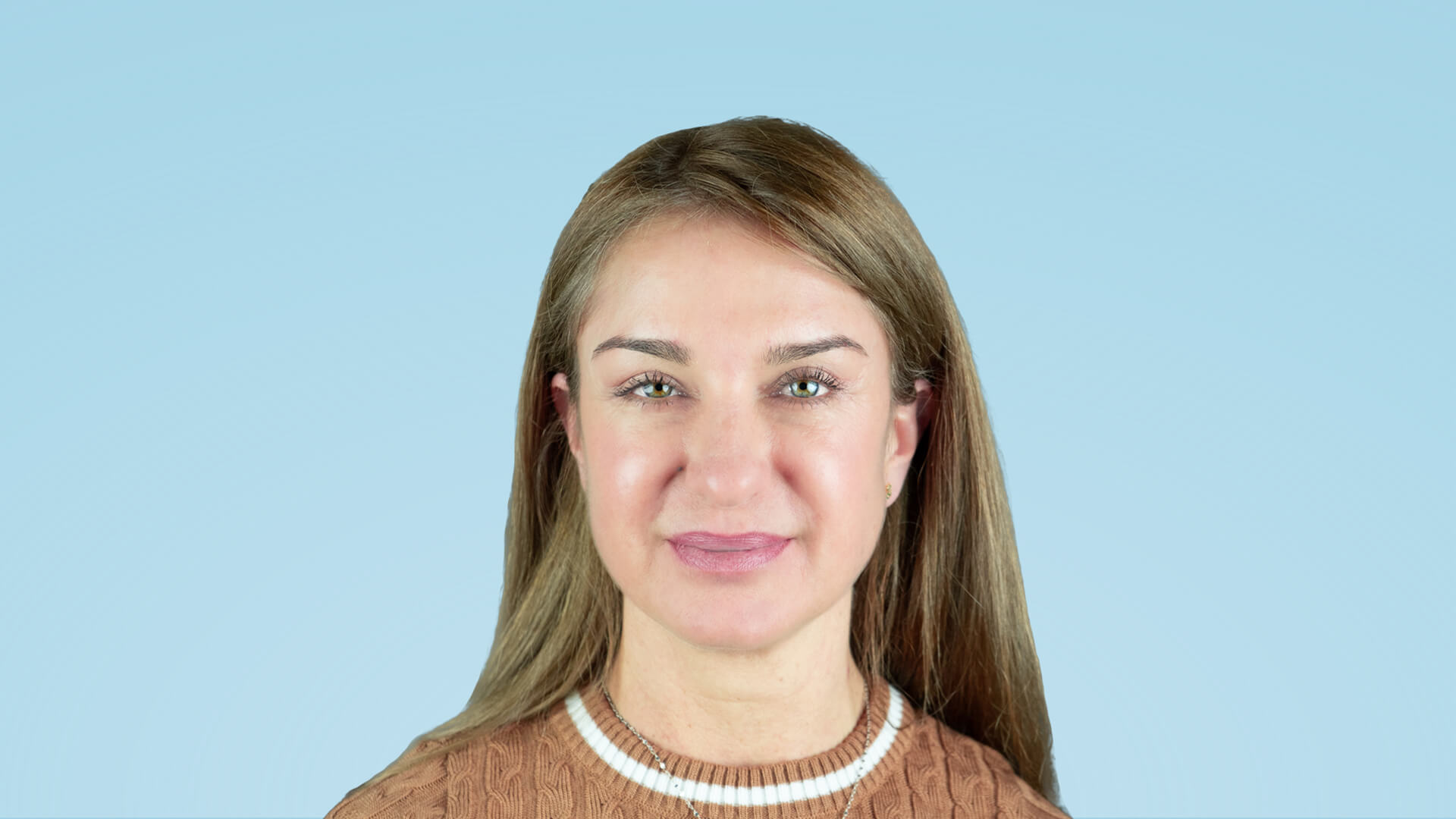 Resultado postoperatorio tras blefaroplastia completa y frontoplastia endoscópica, mirada rejuvenecida y expresión armónica