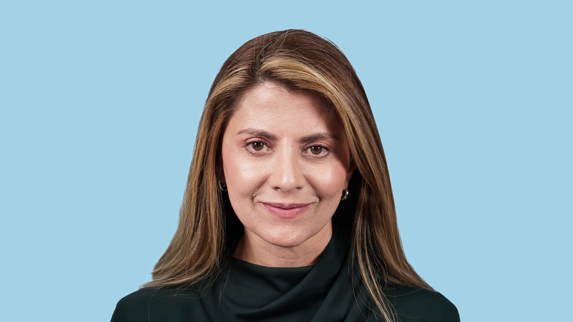  Resultado postoperatorio de blefaroplastia superior, frontoplastia endoscópica y septorrinoplastia con mirada rejuvenecida, cejas en posición natural y perfil nasal armónico, equilibrado y natural.