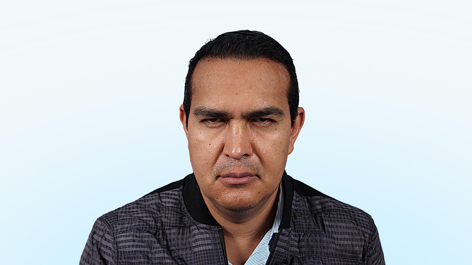 Paciente masculino (profesional de la salud) con pesadez en párpados y cejas descendidas antes de su cirugía de rejuvenecimiento de mirada.