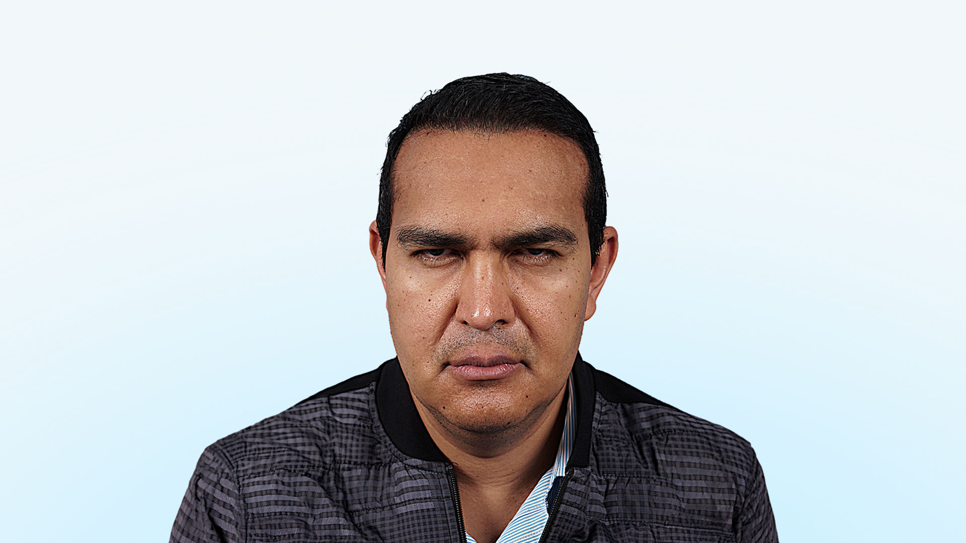 Paciente masculino (profesional de la salud) con pesadez en párpados y cejas descendidas antes de su cirugía de rejuvenecimiento de mirada.