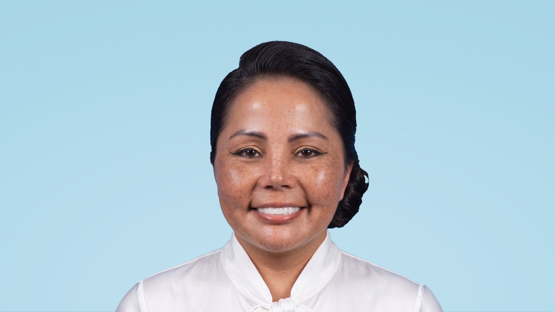 Resultado final de Deep Plane Facelift y Septorrinoplastia realizado por el Dr. Jorge Espinosa Cirujano Plástico Bogotá, mostrando un rostro armónico, contorno mandibular definido y una mirada fresca.