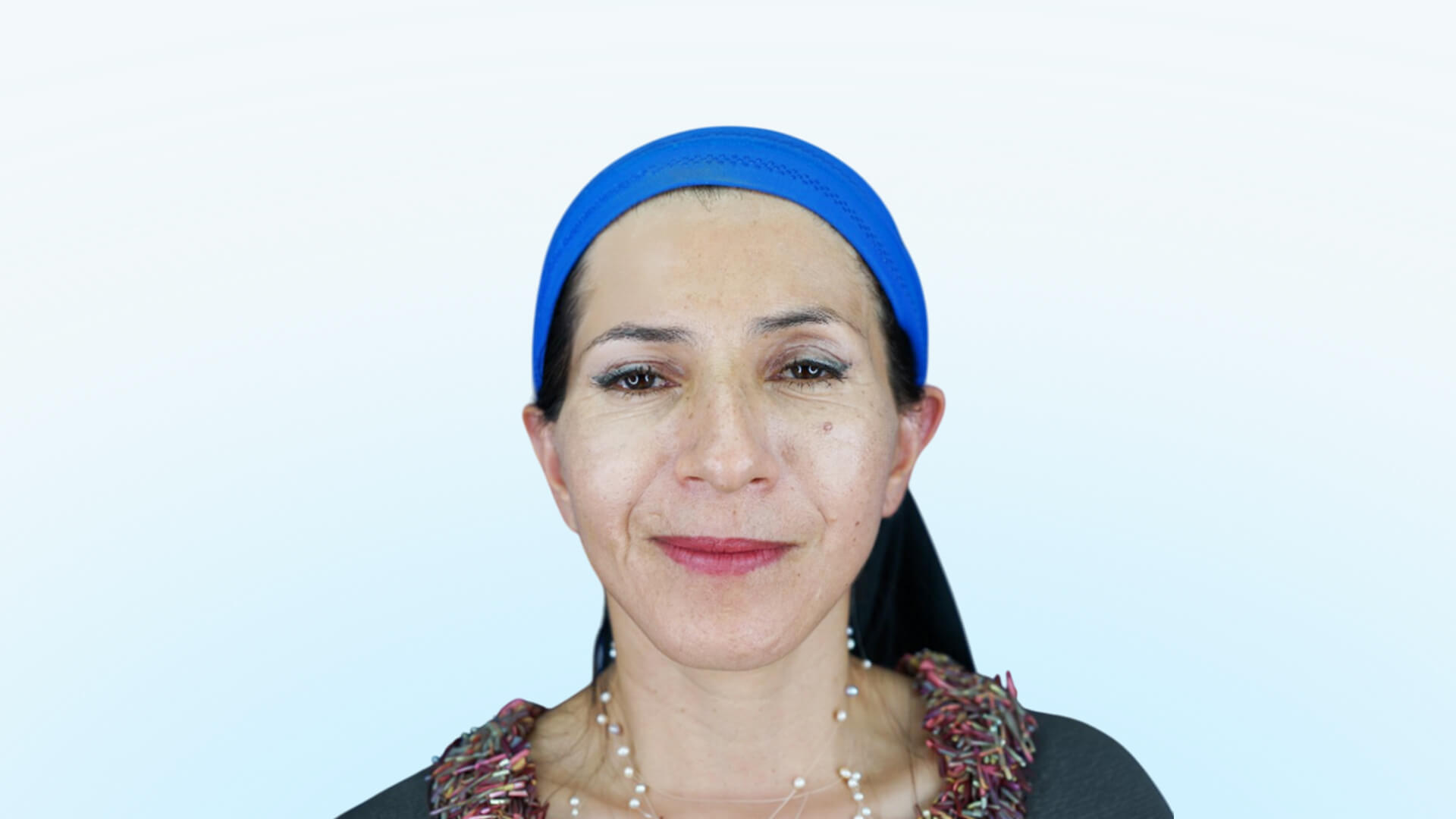 Paciente femenina con descenso de mejillas (jowls), mirada cansada, exceso de piel en párpados y pérdida de definición en el cuello previo a rejuvenecimiento facial con ritidoplastia de plano profundo en Bogotá por el Dr. Jorge Espinosa.