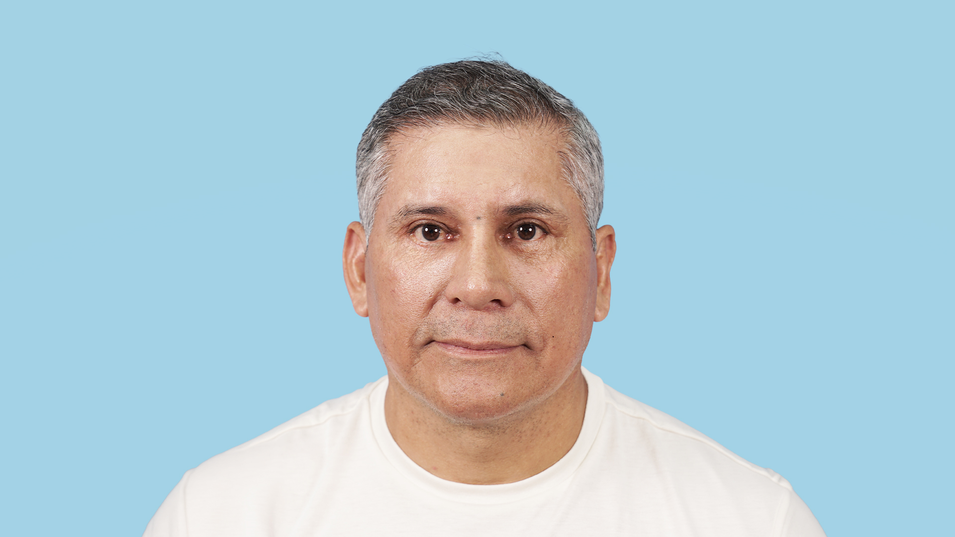 Resultado real a las 6 semanas de rejuvenecimiento facial con técnica Deep Plane, blefaroplastia y frontoplastia por el Dr. Jorge Espinosa, mostrando un rostro masculino rejuvenecido, fresco y muy natural.