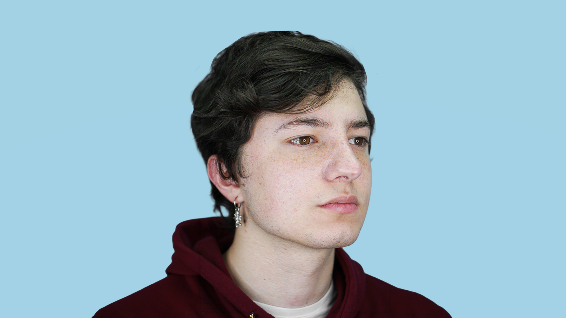 Resultado real de masculinización facial, mentoplastia y definición de contorno mandibular en paciente joven por el Dr. Jorge Espinosa en Bogotá.