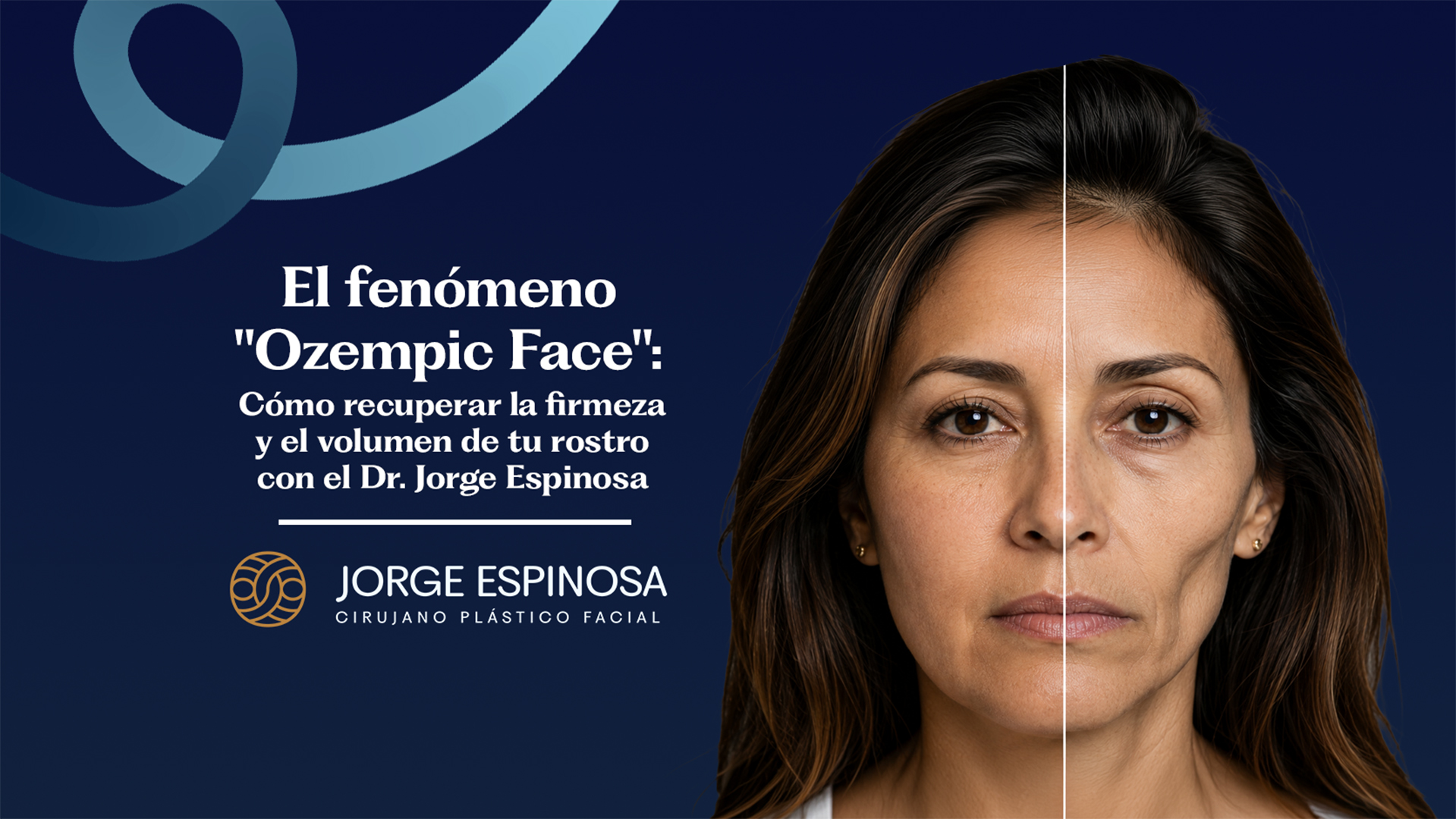 Mujer con el rsotro dividido en dos, mostrando el antes y el después de un rostro tras la utilización de ozempic