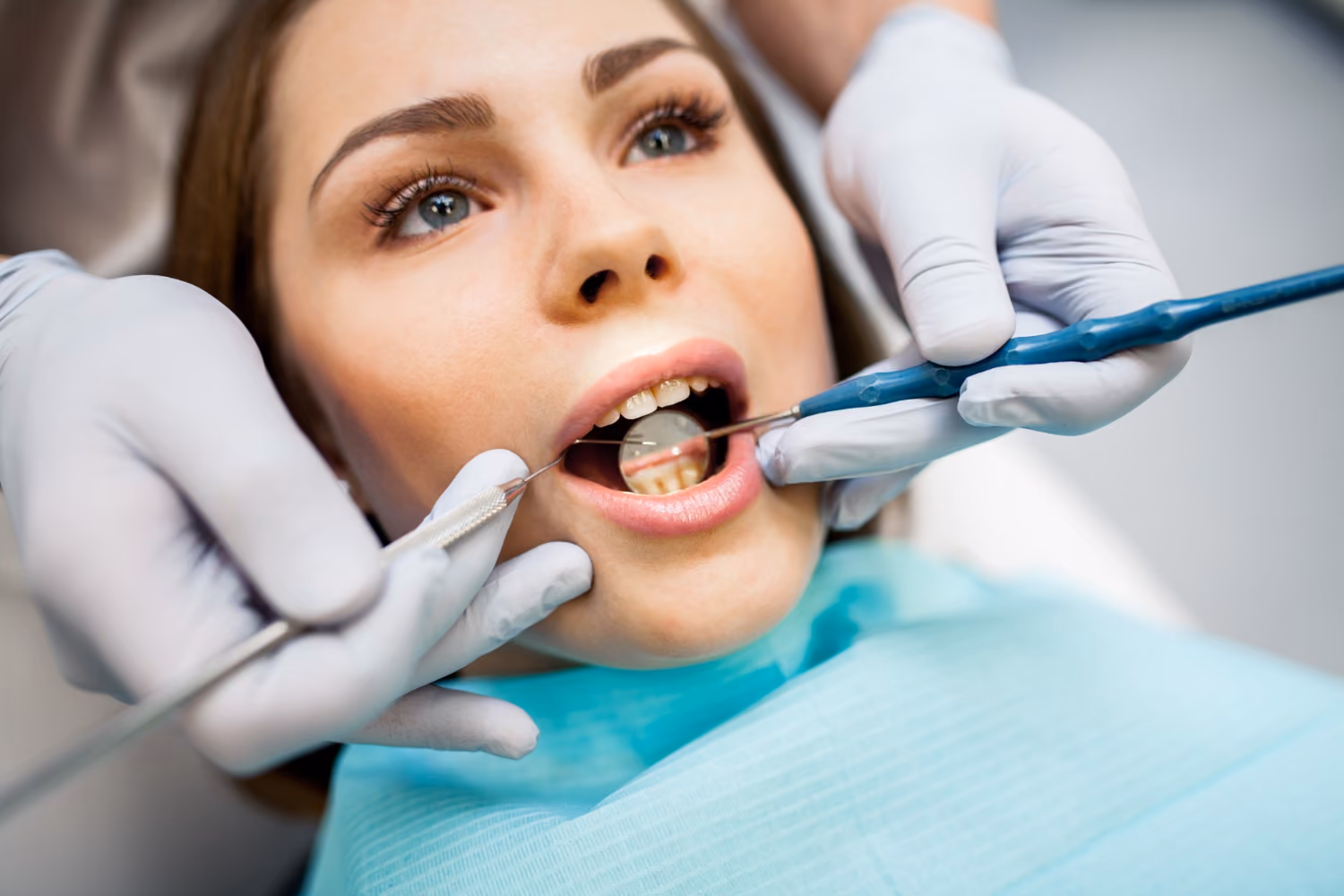 composite teeth fillings