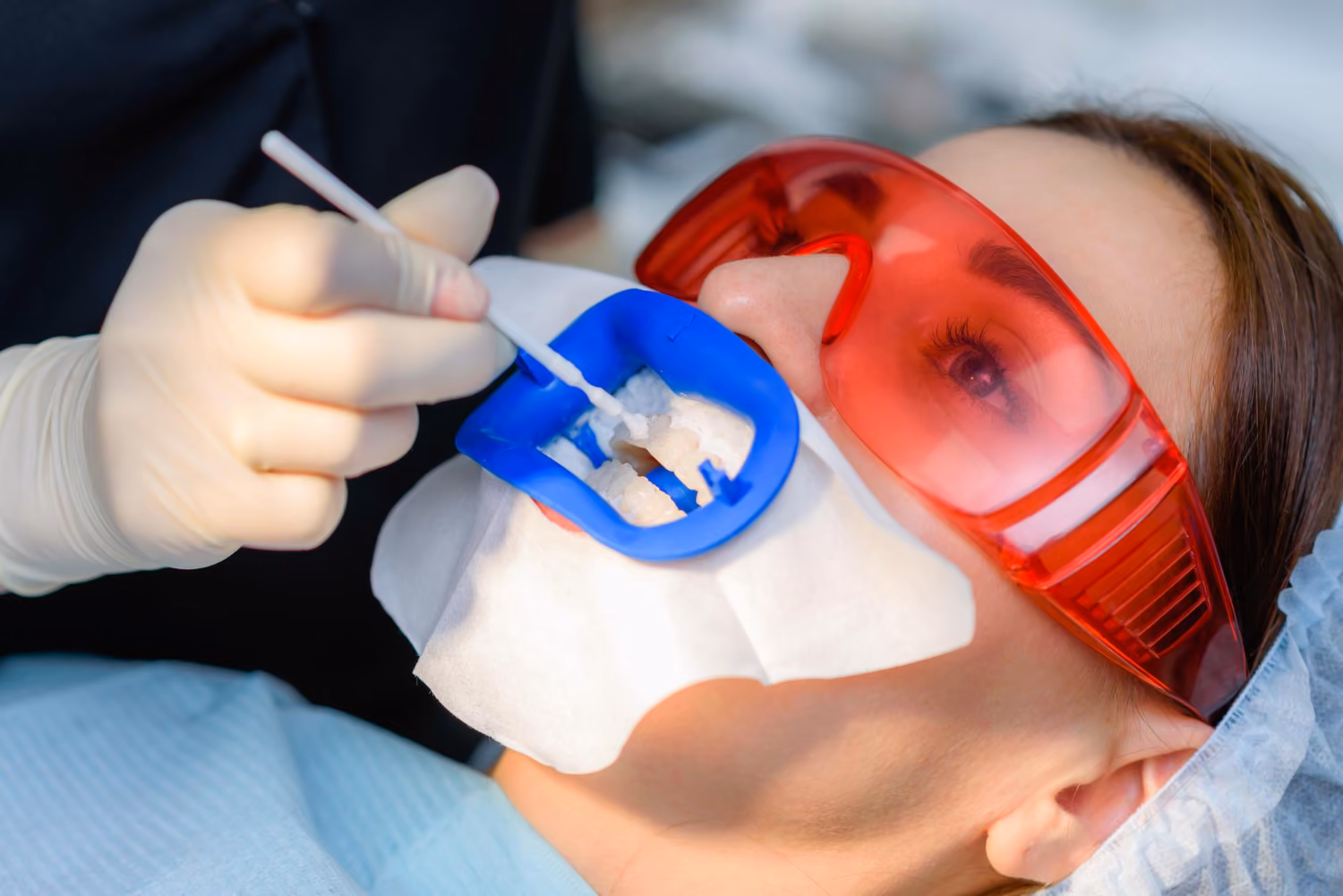 Patient undergoing dental procedure wearing red protective glasses and a blue mouth retractor.