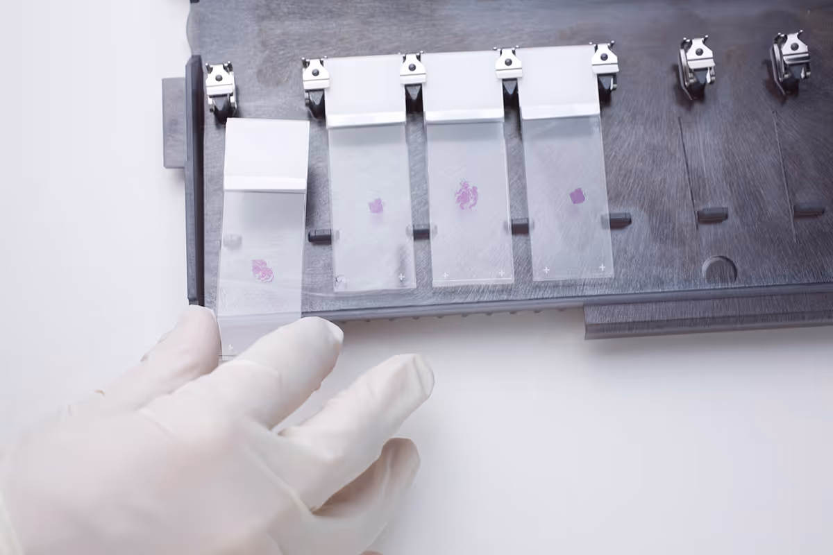 High Speed Slide Scanning