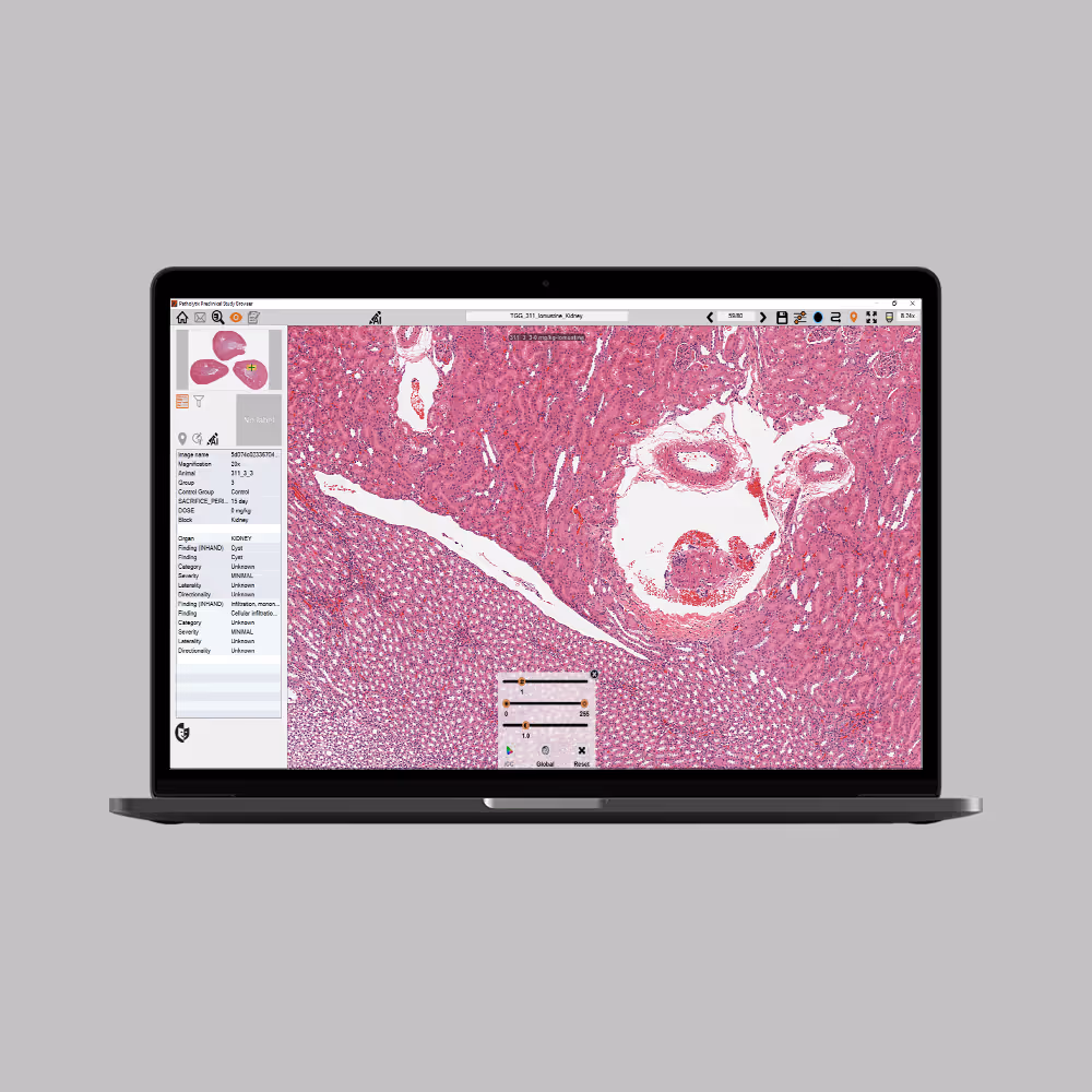 Patholytix Preclinical