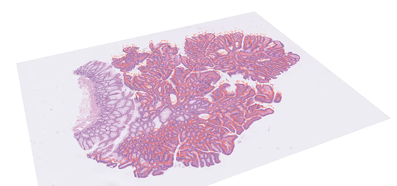 Image of slide with partial overlay