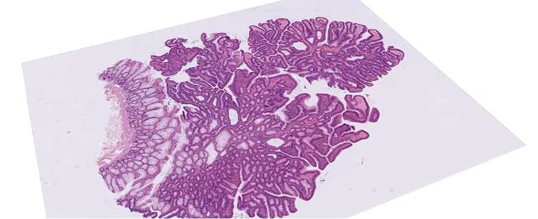 Image of slide with no overlay