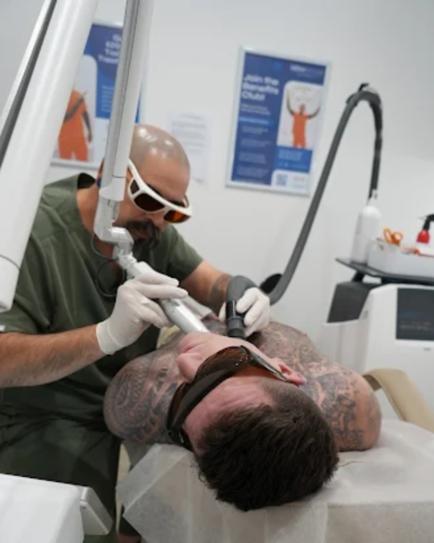 Does tattoo removal hurt