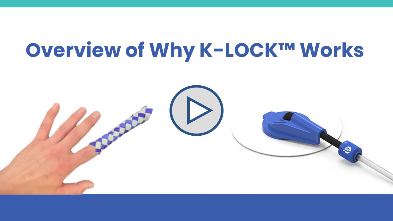 Play button for video: Overview and Summary of How K-LOCK™ works like a Chinese finger trap to reliably and comfortably hold a surgical drain tube