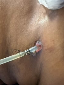 Image of human hand with Chinese finger trap shown on index finger