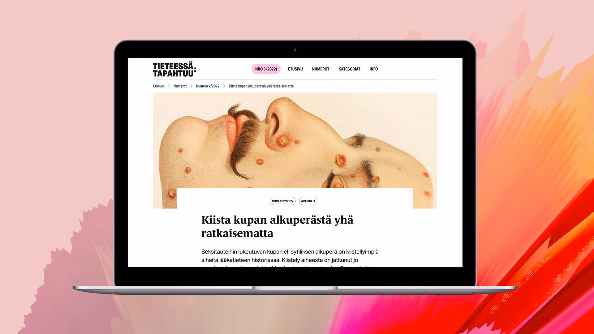 Artikkelin ulkoasun pääkuva tietokoneen ruudulla. Pääkuvassa on vanhapiirroskuva miehen kasvoista, jota peittää paiseet.