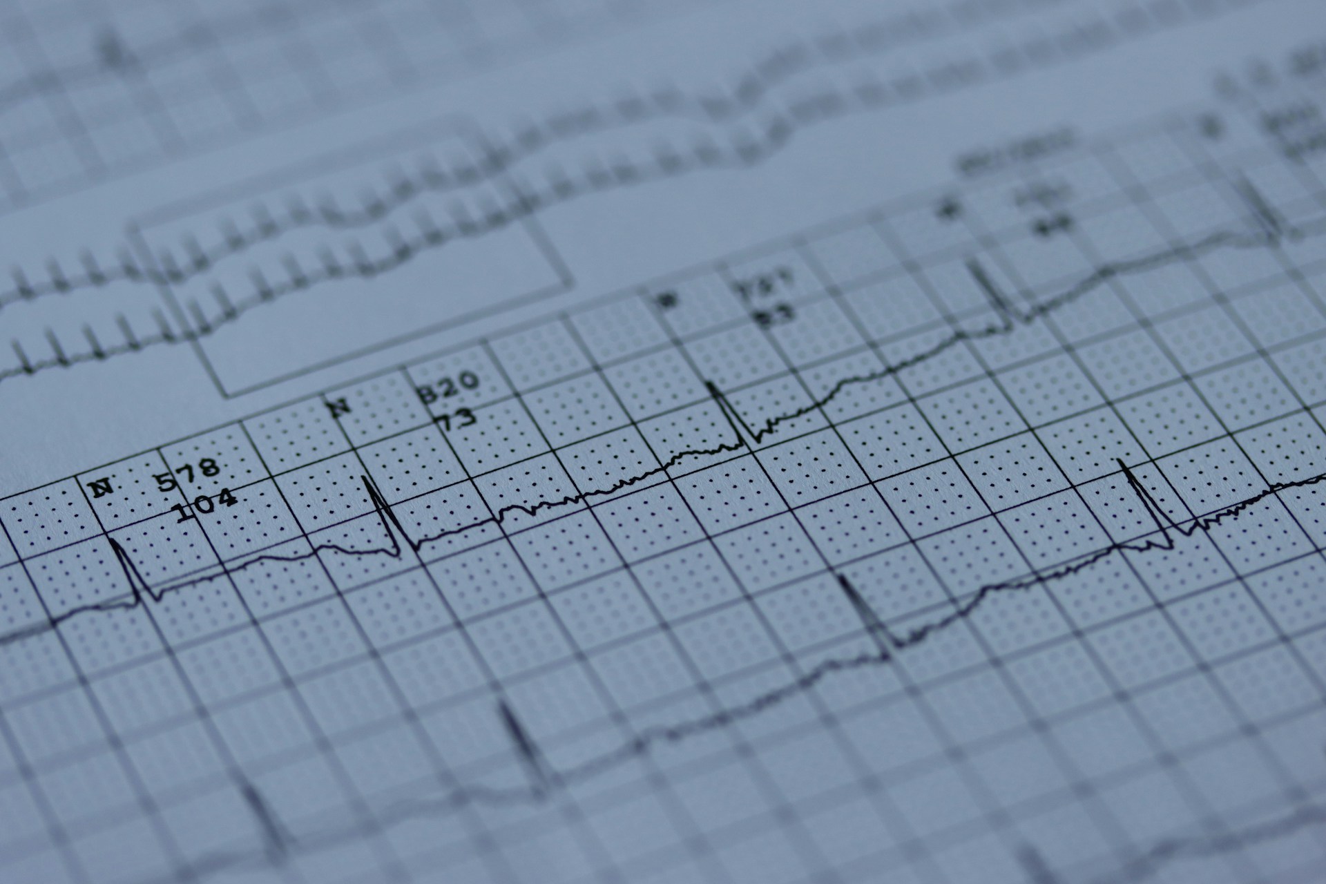 Palpitations cardiaques nocturnes : les comprendre et les traiter