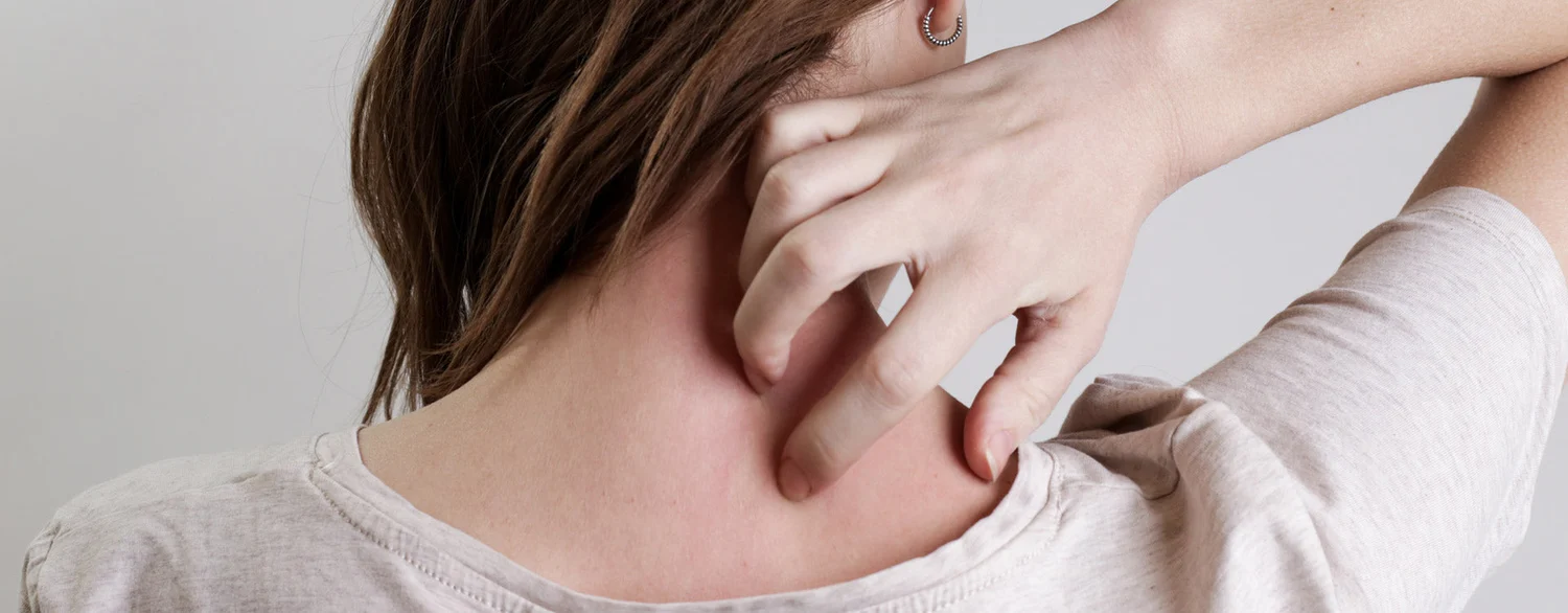 Les liens entre le stress et l'eczéma: causes, symptômes et solutions