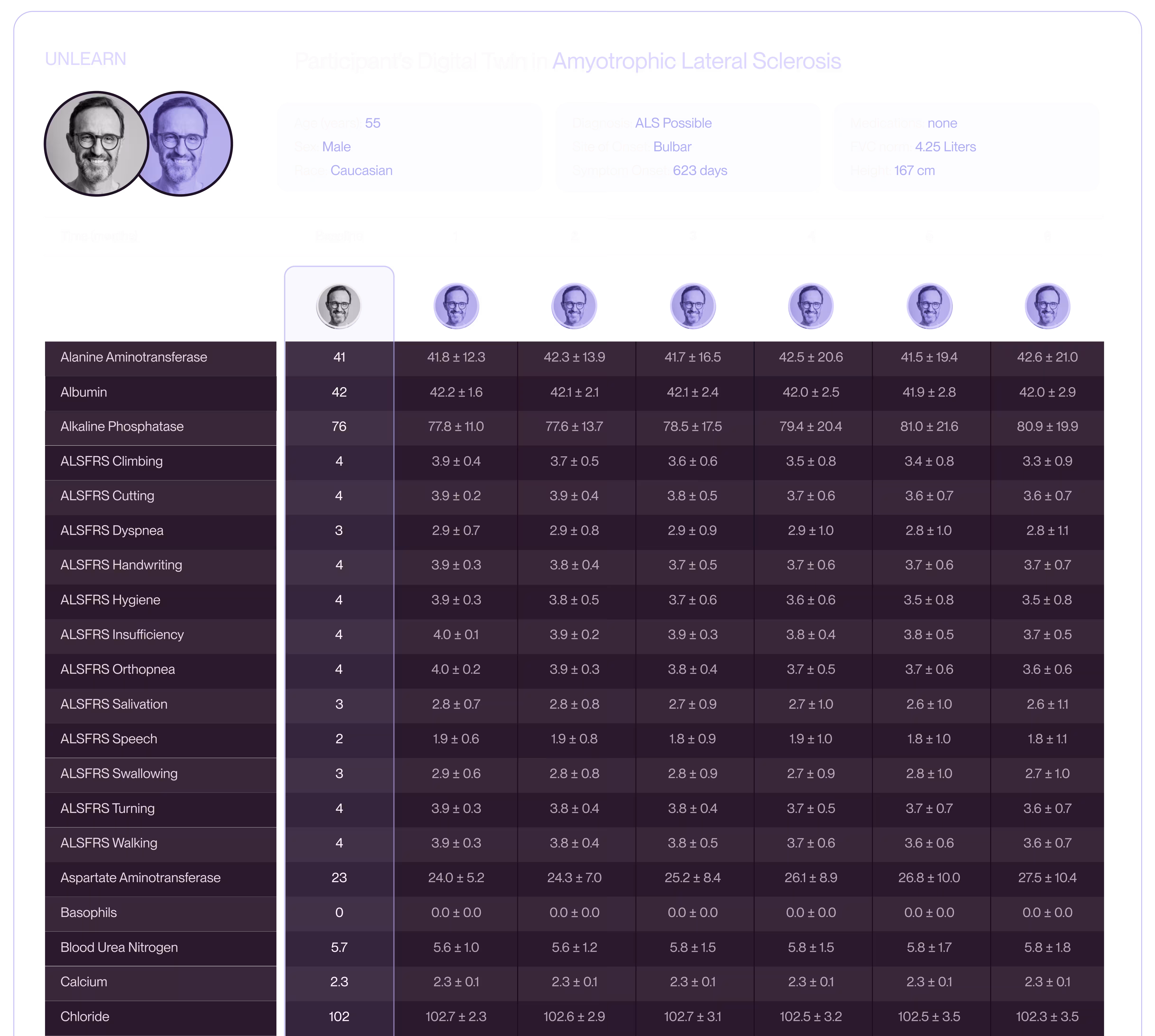 Sample digital twin record for a participant in an Alzheimer's disease trial, showing baseline scores and forecasts from 6 to 24 months