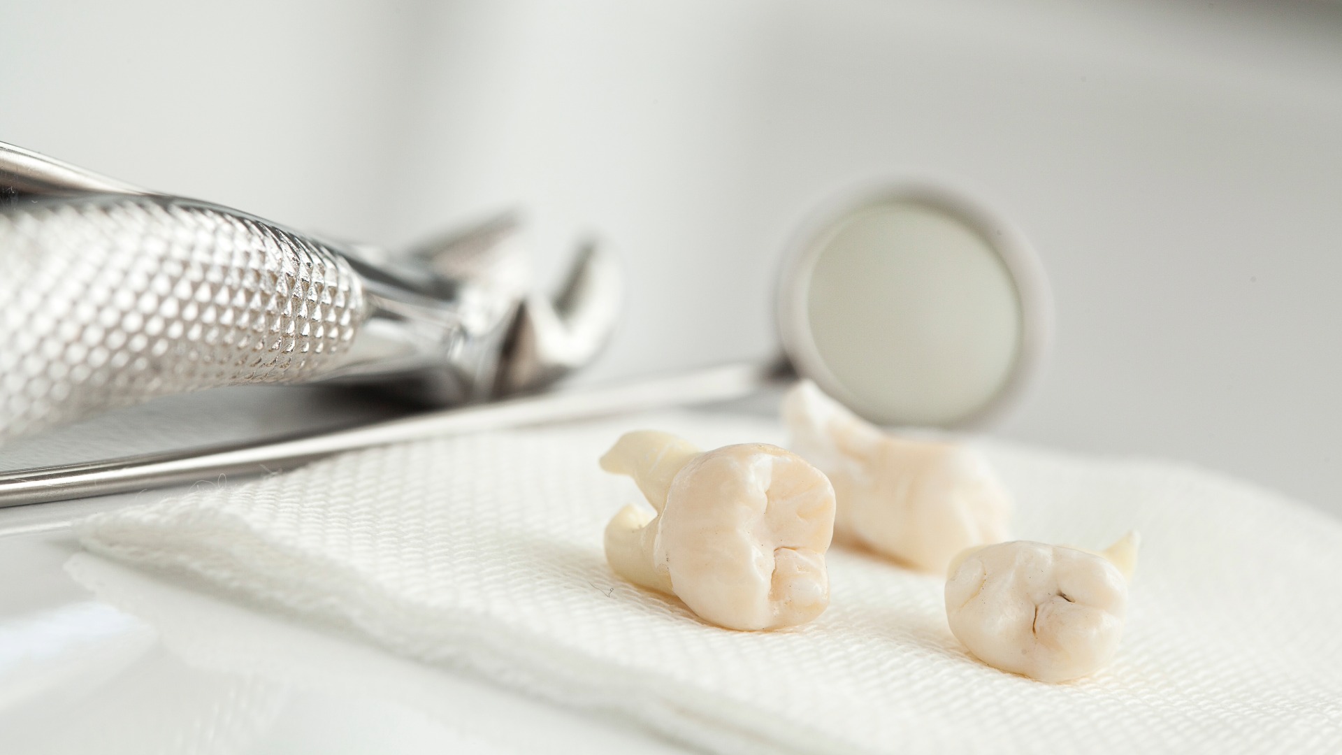 Three extracted wisdom teeth on paper towel